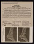 Lower Limb. Inner Side of Ankle - no. 1